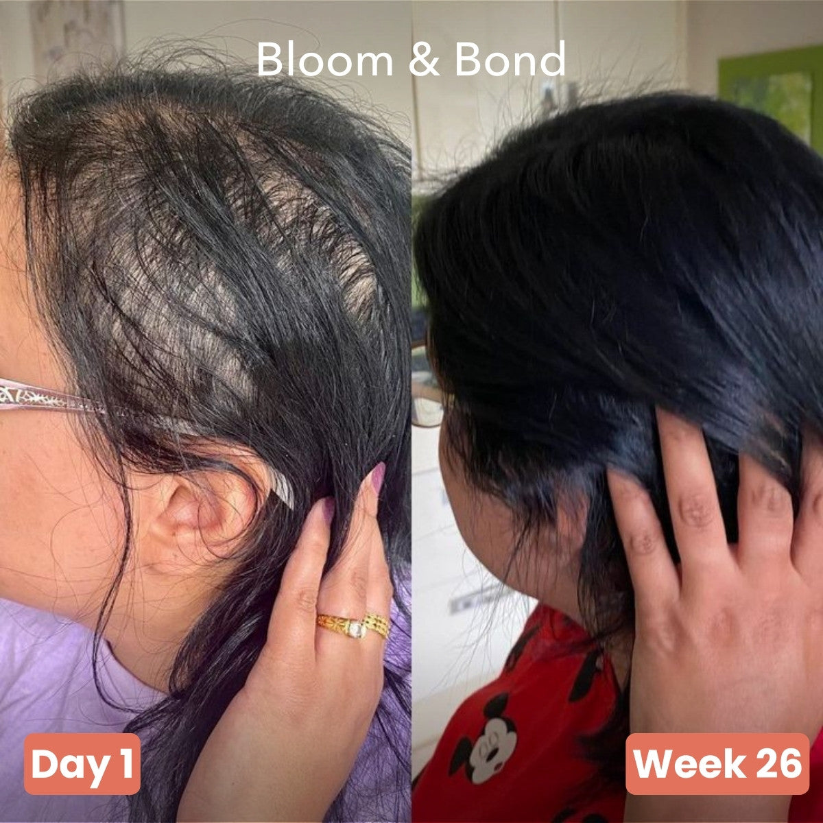 Pumpkin Seed Oil Softgels UPSELL